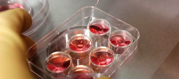 an-employee-demonstrates-the-process-to-extract-eggs-in-a-lab-at-the-e-stork-reproductive-center-in-hsinchu_5130520